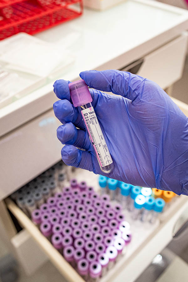 Punkt pobrań krwi - profesjonalne usługi laboratoryjne