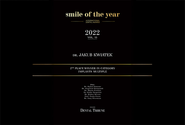 Międzynarodowy Konkurs Smile of The Year 2022 by Dental Tribune II miejsce